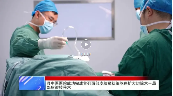 【视频新闻】县中医医院成功完成首列面部皮肤鳞状细胞癌扩大切除术＋局部皮瓣转移术